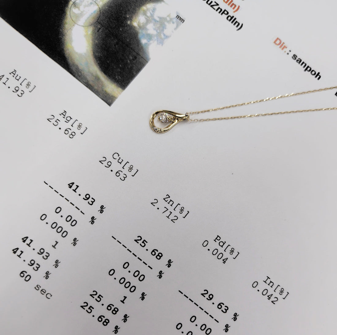 金属アレルギー